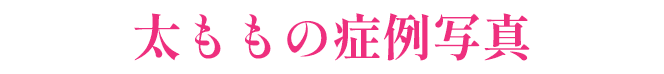 顔の症例写真
