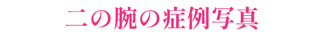顔の症例写真