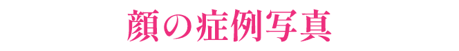 顔の症例写真
