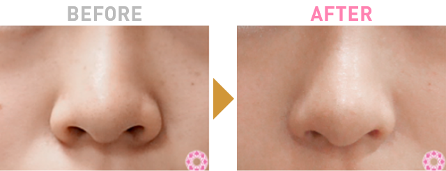 Before After 2