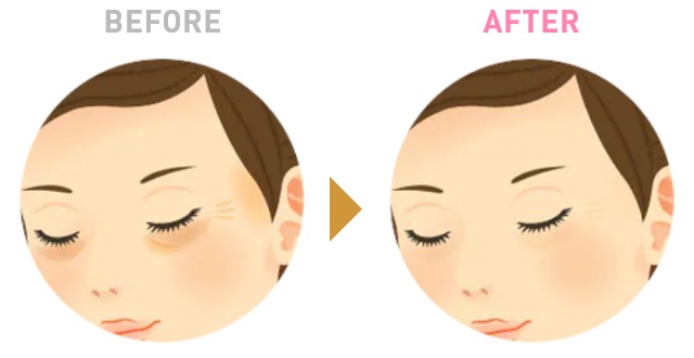 Before After 4