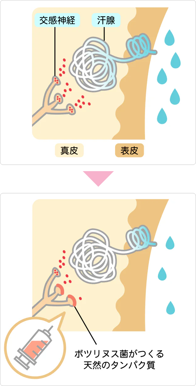 Before After 2