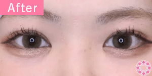 after