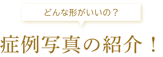 症例写真の紹介！