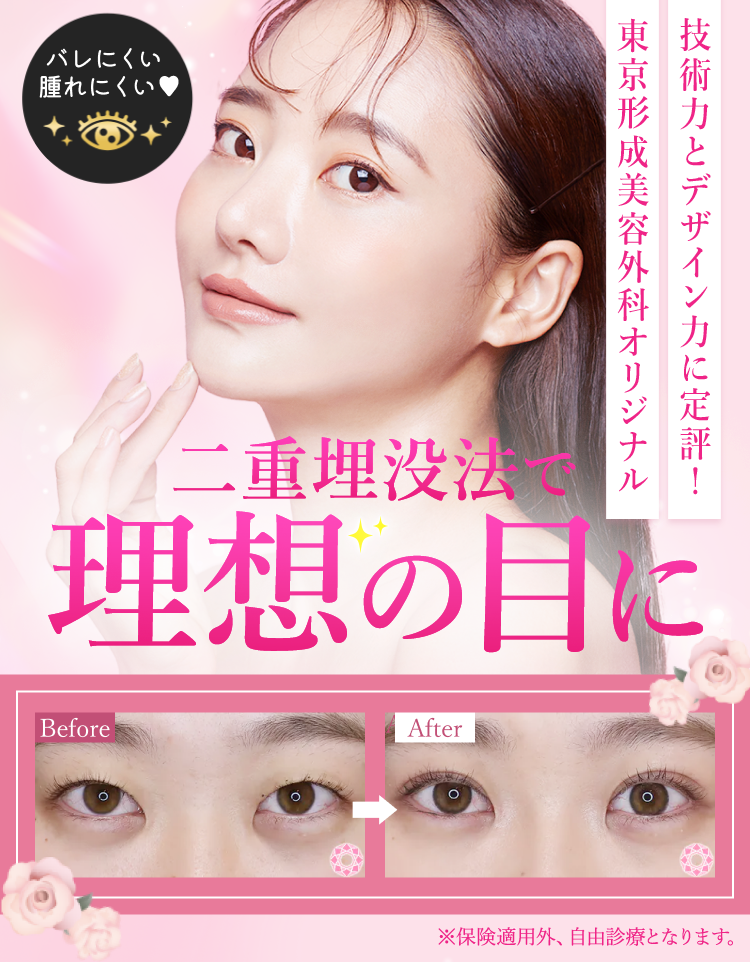 東京形成美容外科オリジナル 二重埋没法
